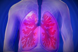 pulmones con neumonía